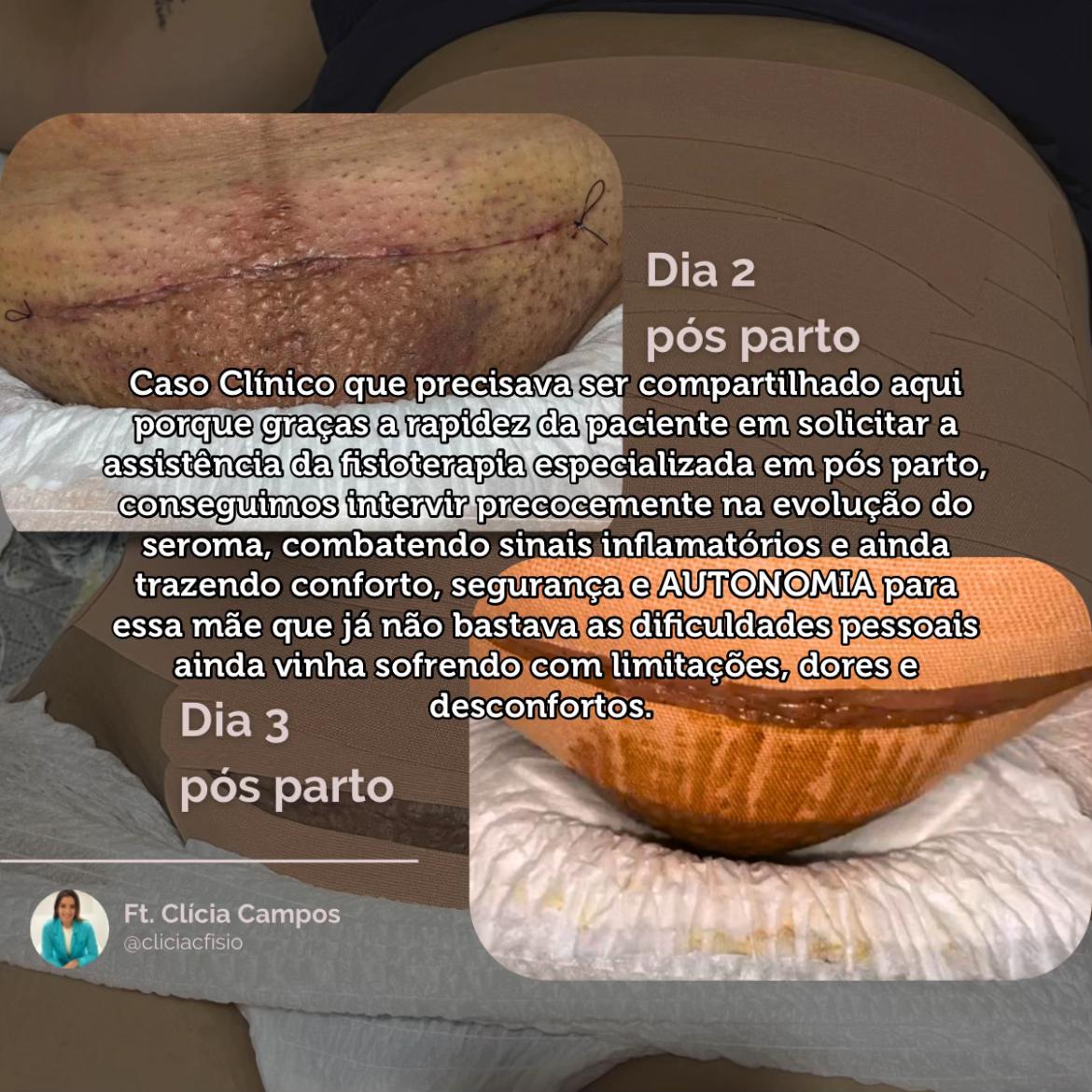 @cliciacfisio