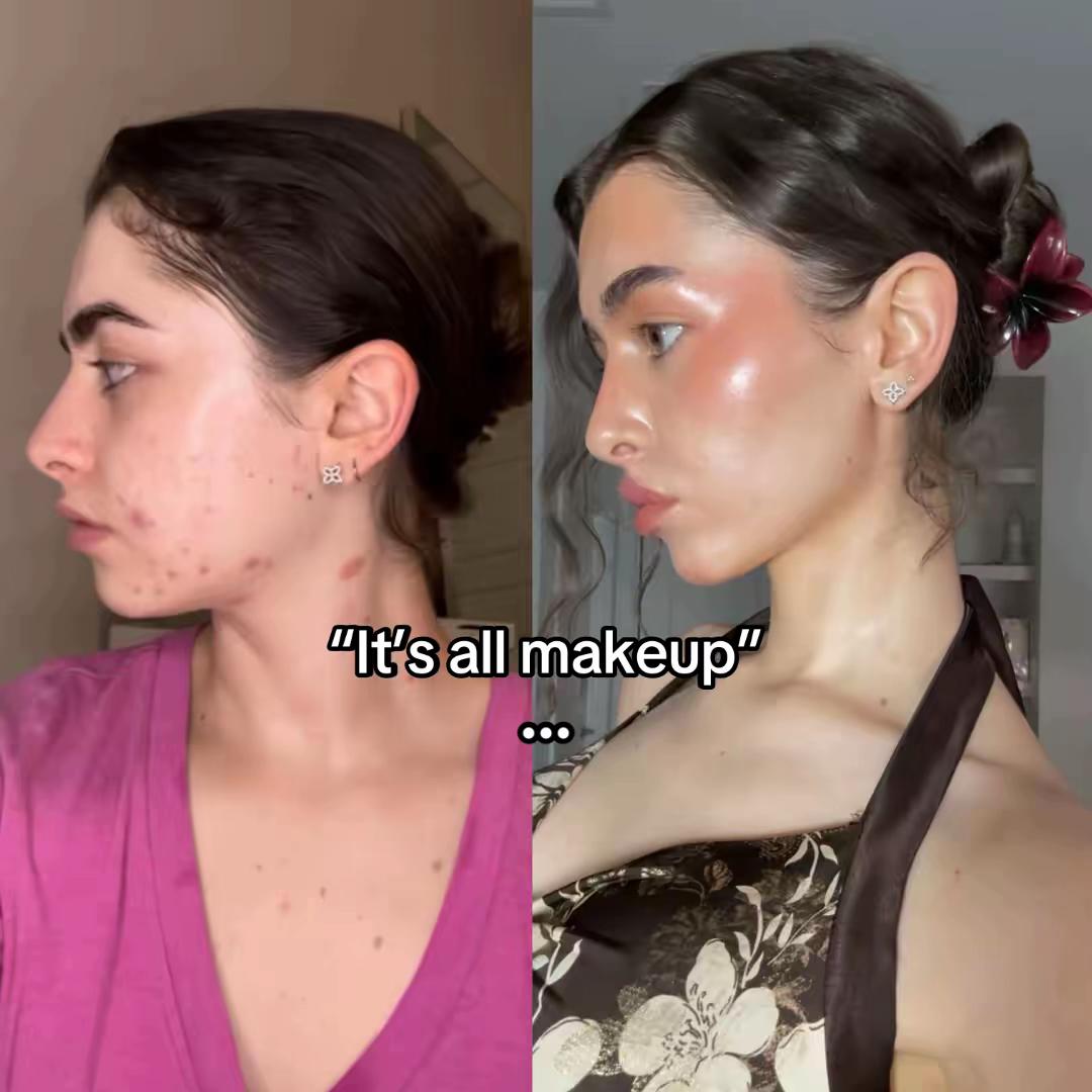 @Dani