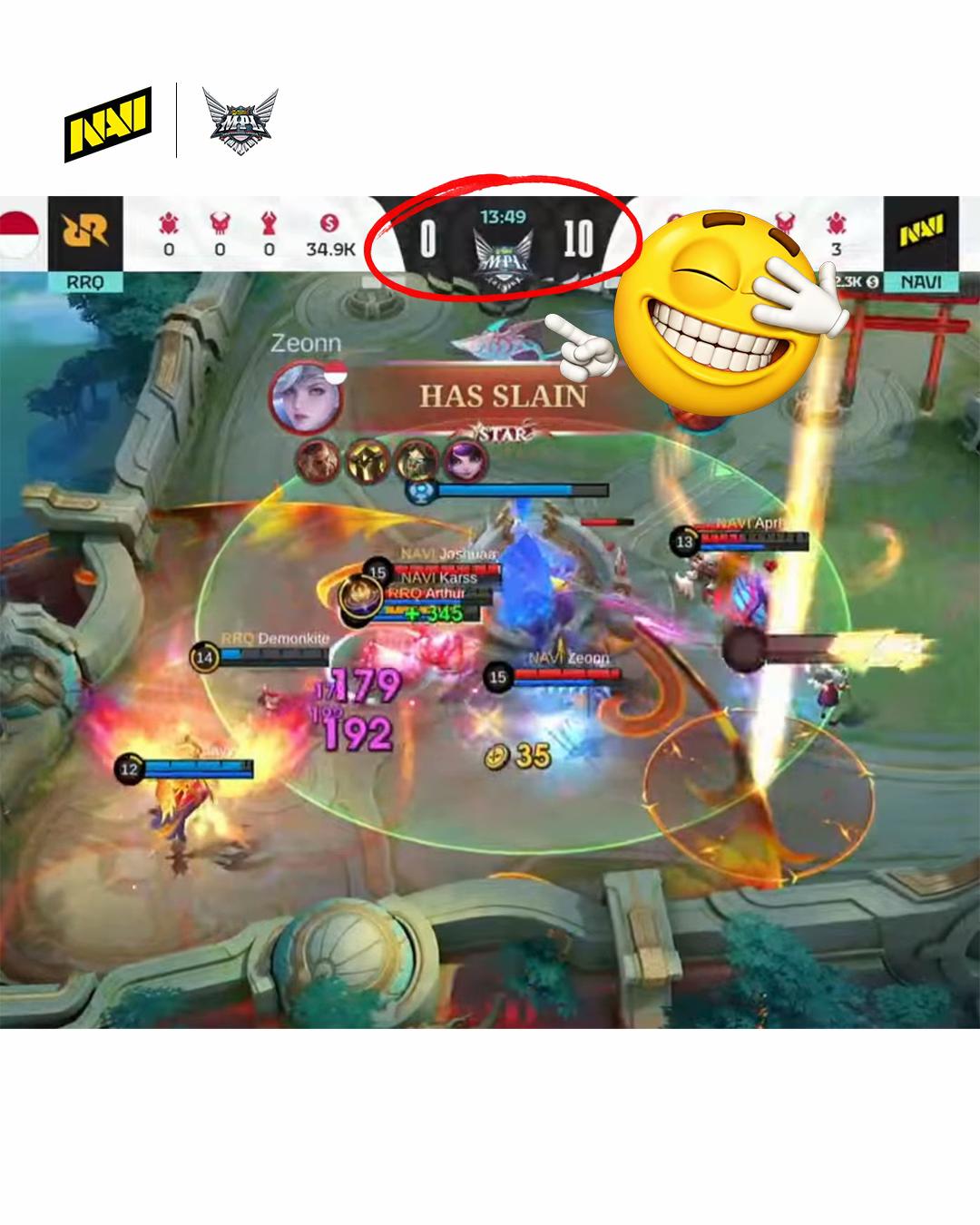 @NAVI MLBB