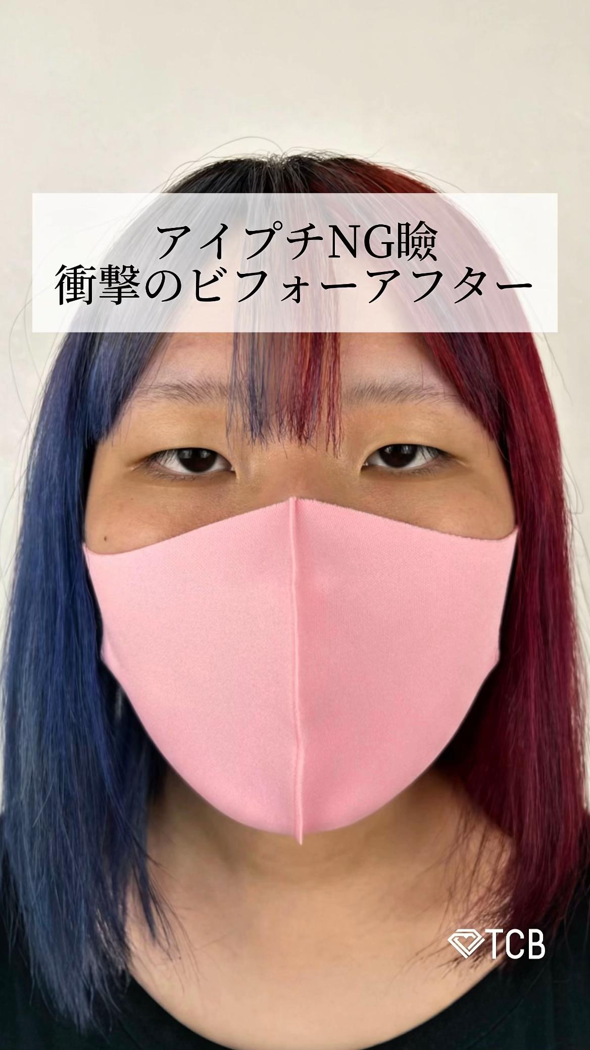 @【二重整形】TCB 新宿東口院ゆいこ先生/東京