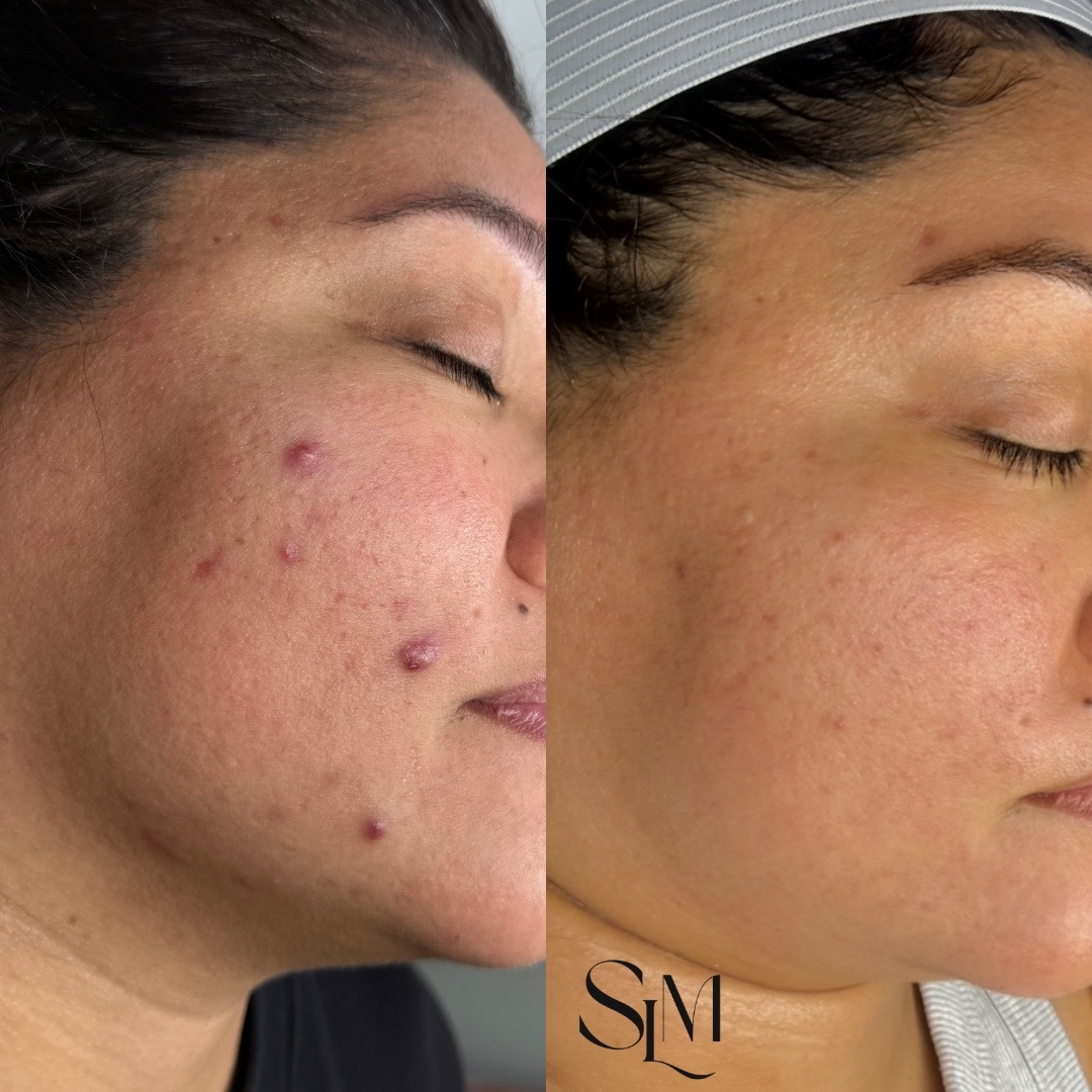 @Myrah | Midland Aesthetician