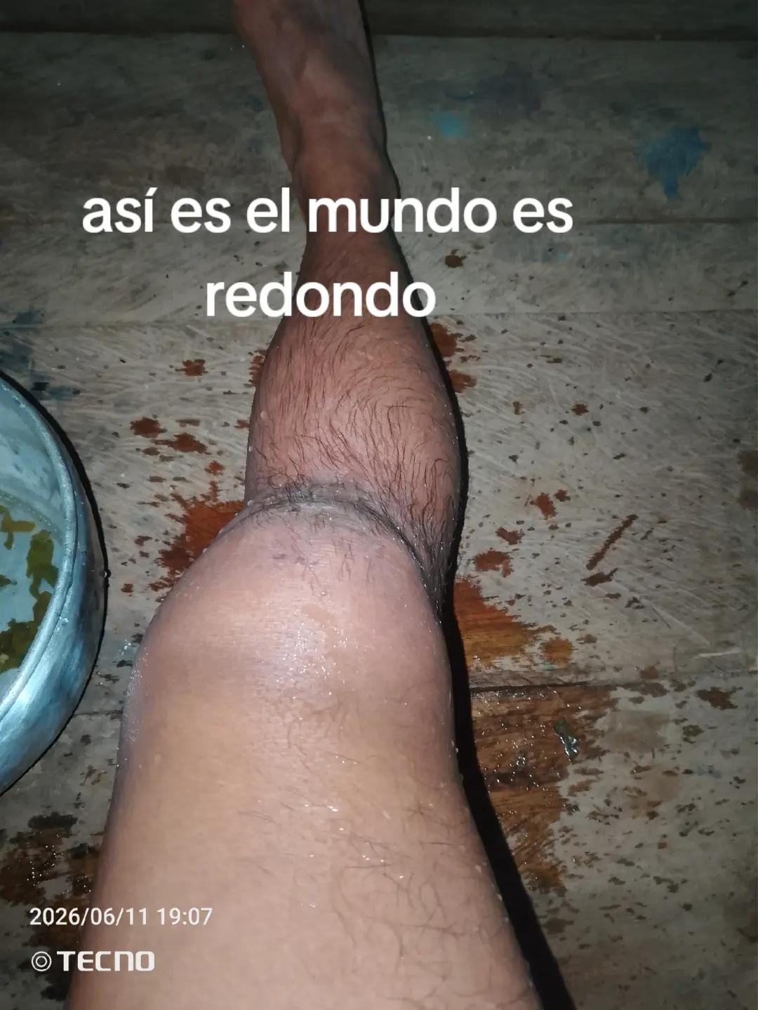 @ivan chiguango