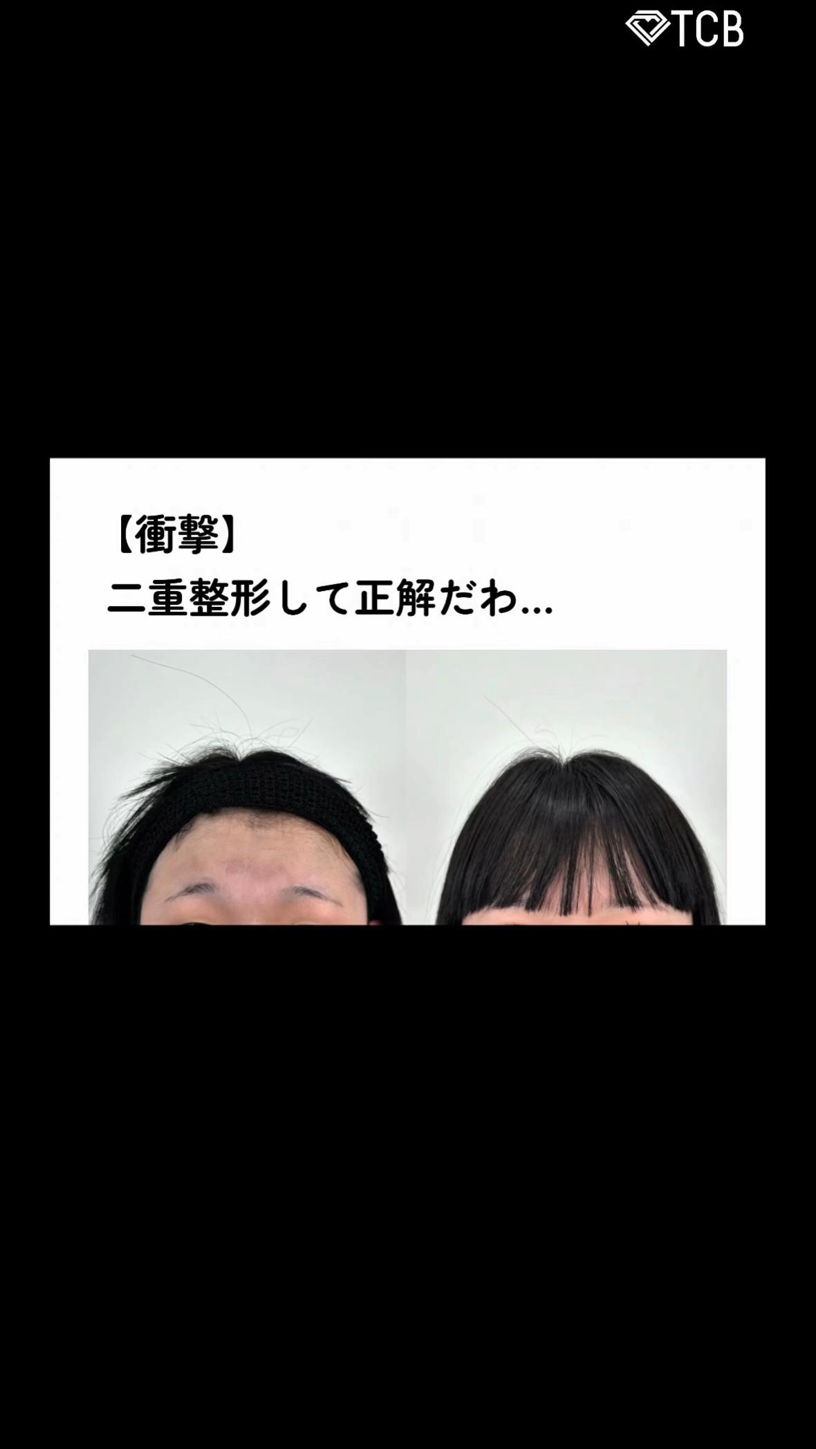 @【クマ取り/小顔整形】TCB京都駅前院 院長　橋本晋太朗
