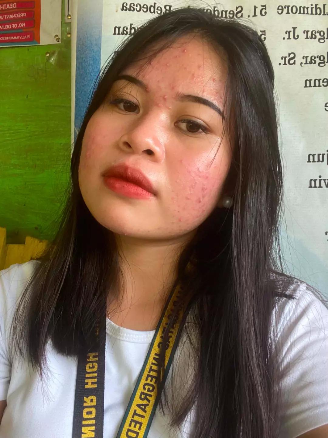 @Je Lai