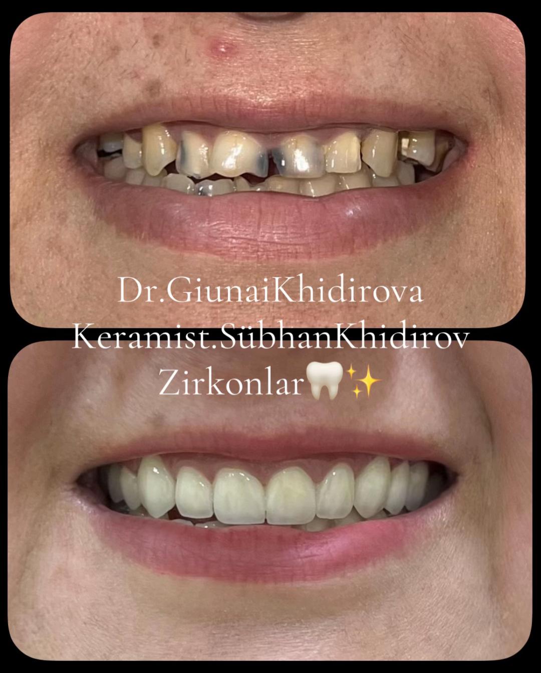 @Dr.Гюнай