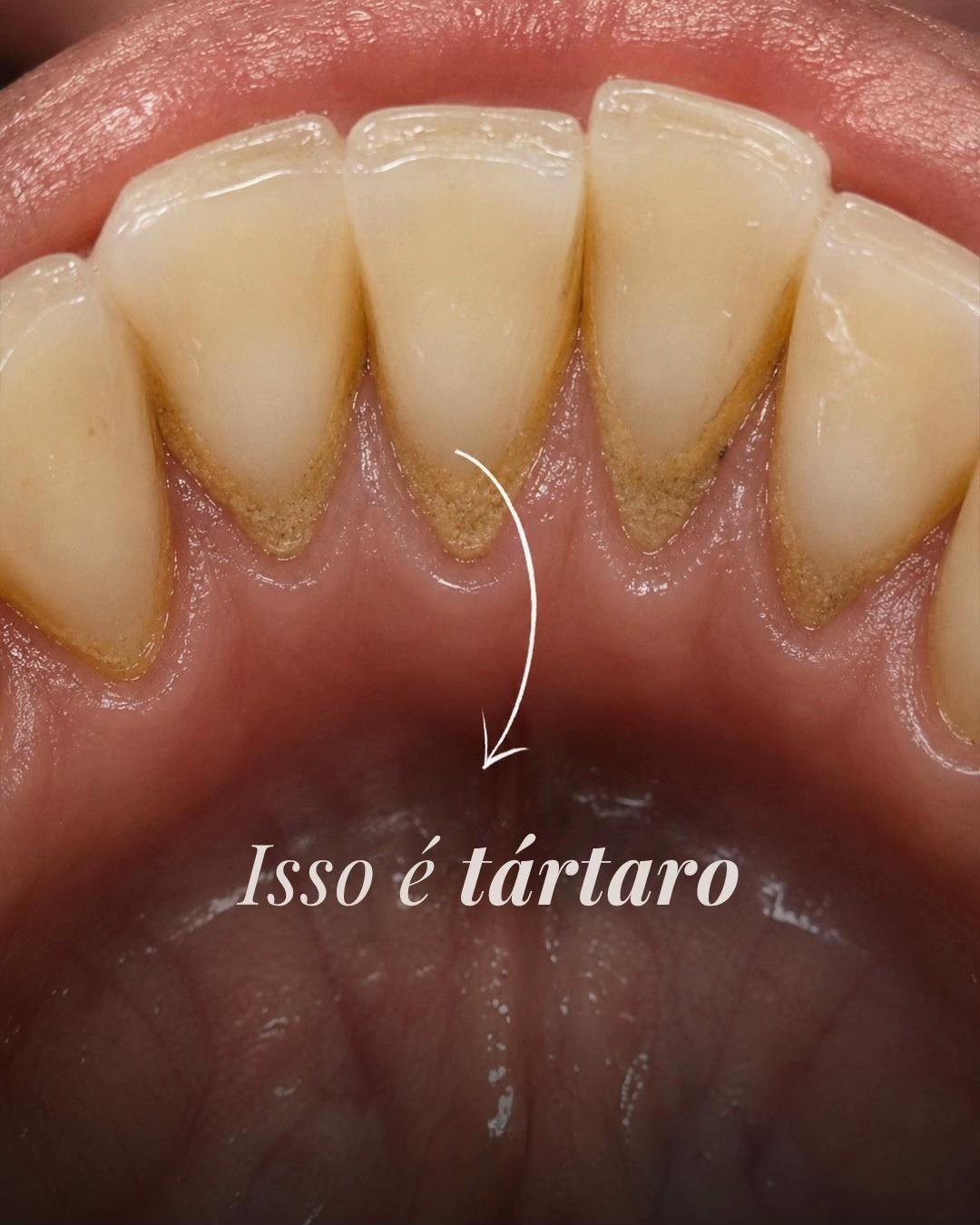 @Edinei Dias