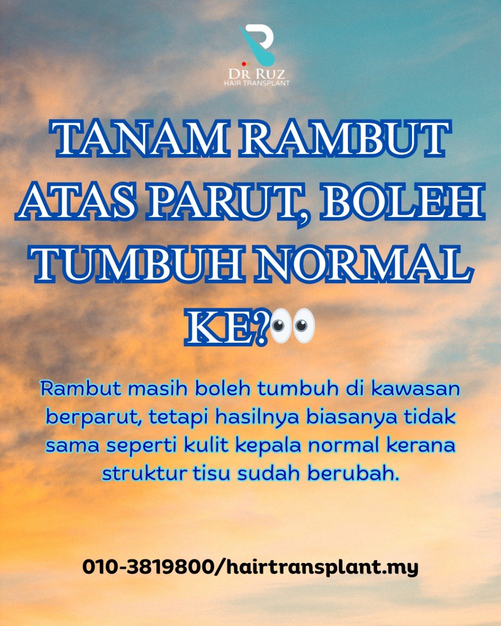 @dr.ruzhairtransplant