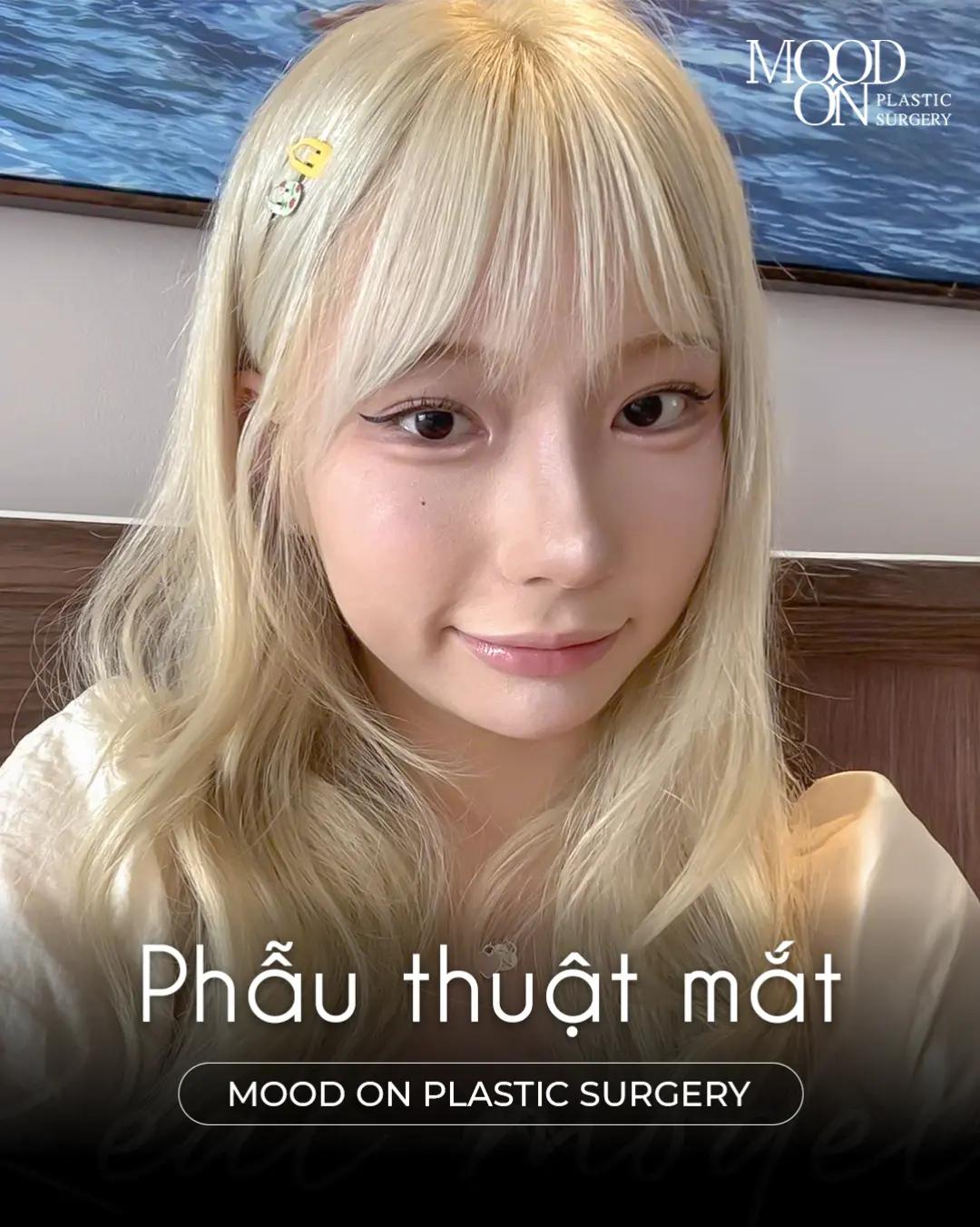@Bệnh viện thẩm mỹ Mood On