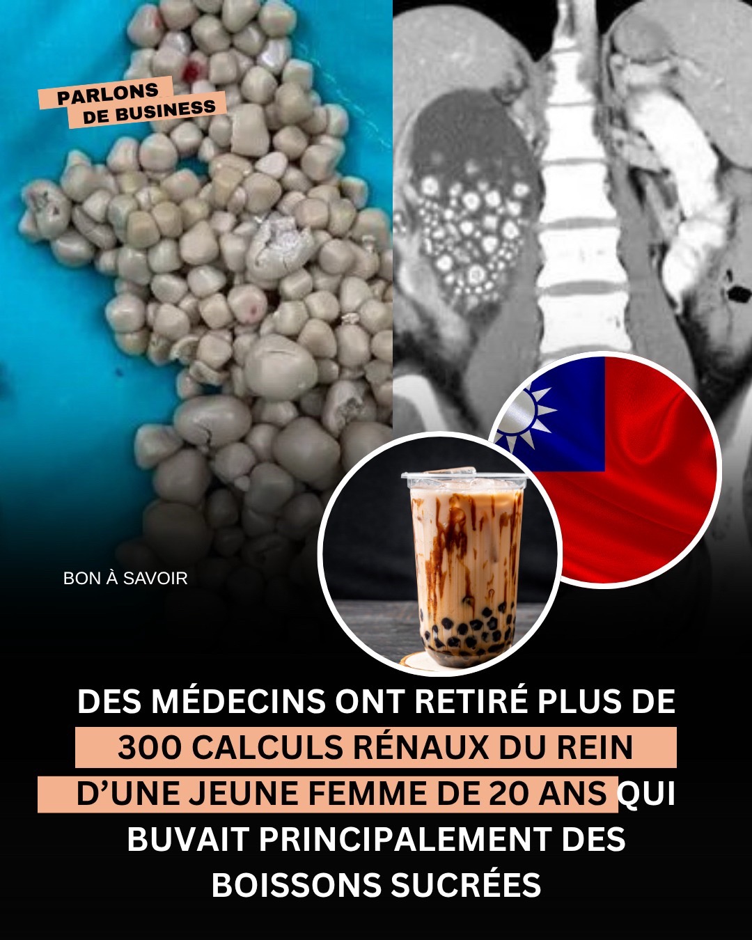 @Parlons De Business