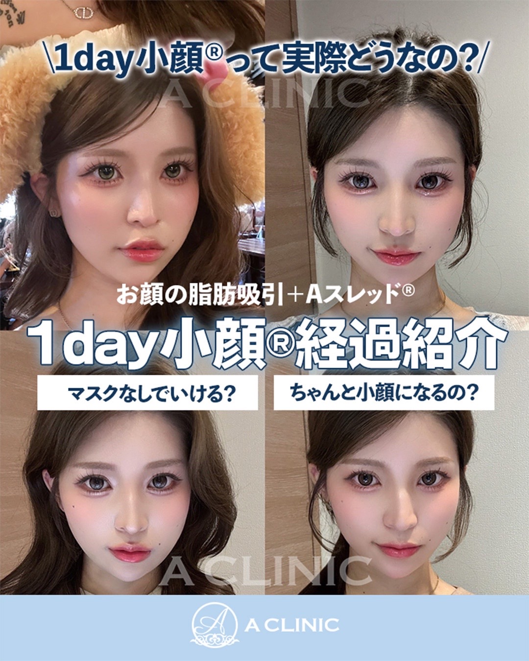 @ACLINIC池袋院【小顔/中顔面短縮】