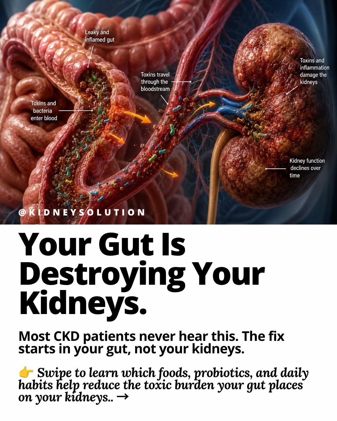 @Kidneysolution