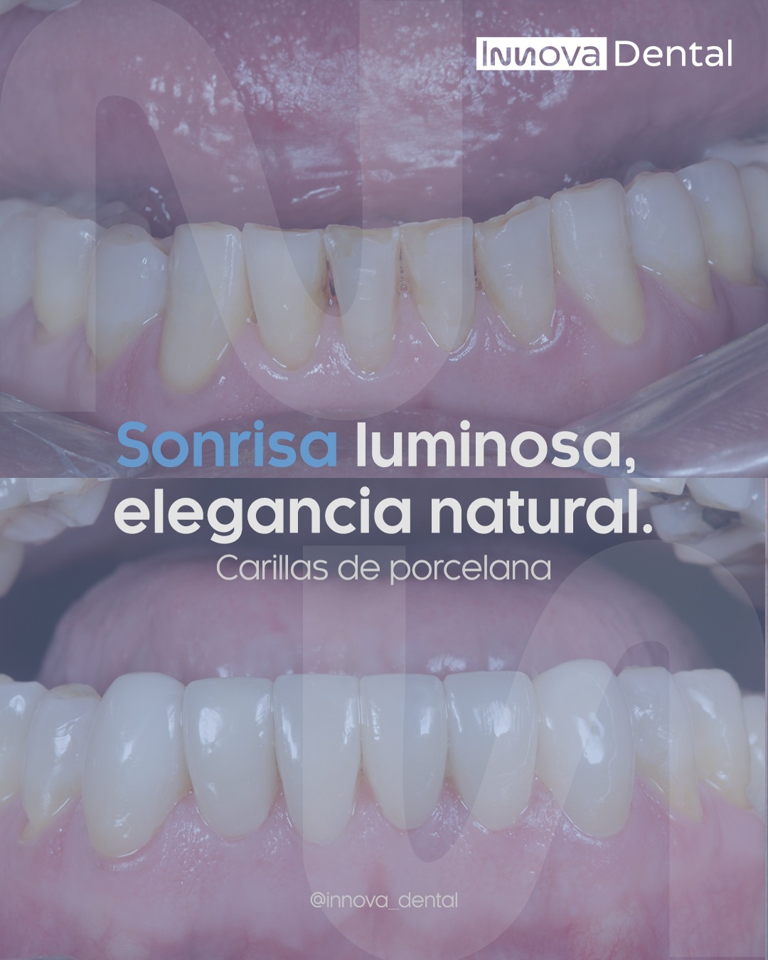 @Innova Dental Managua 🇳🇮