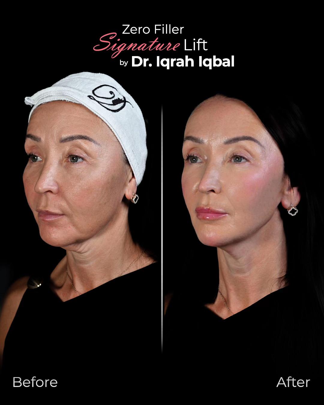 @Dr.Iqrah.Aesthetics