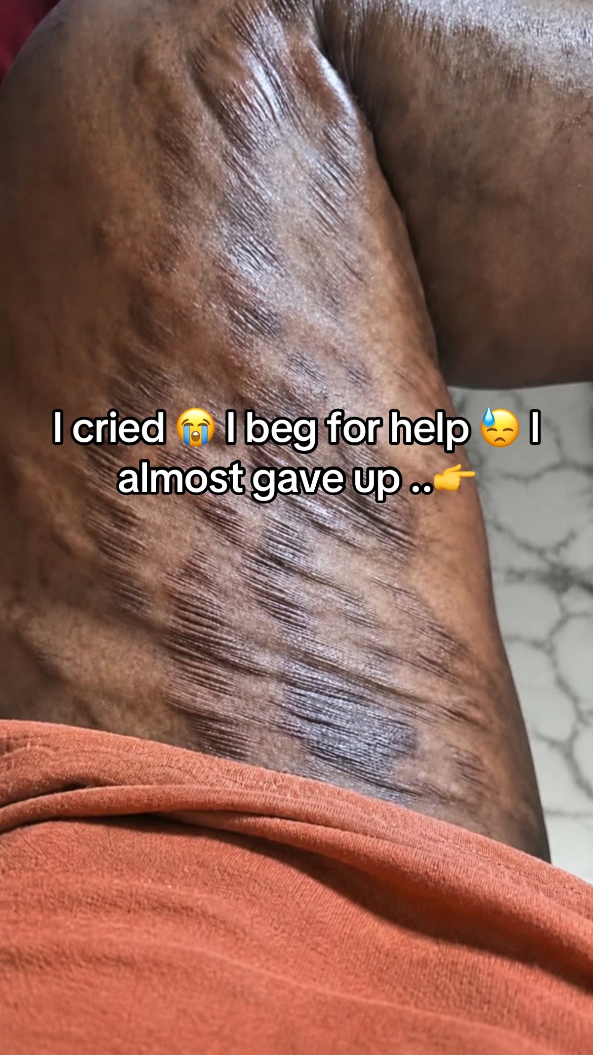 @Radiant skin