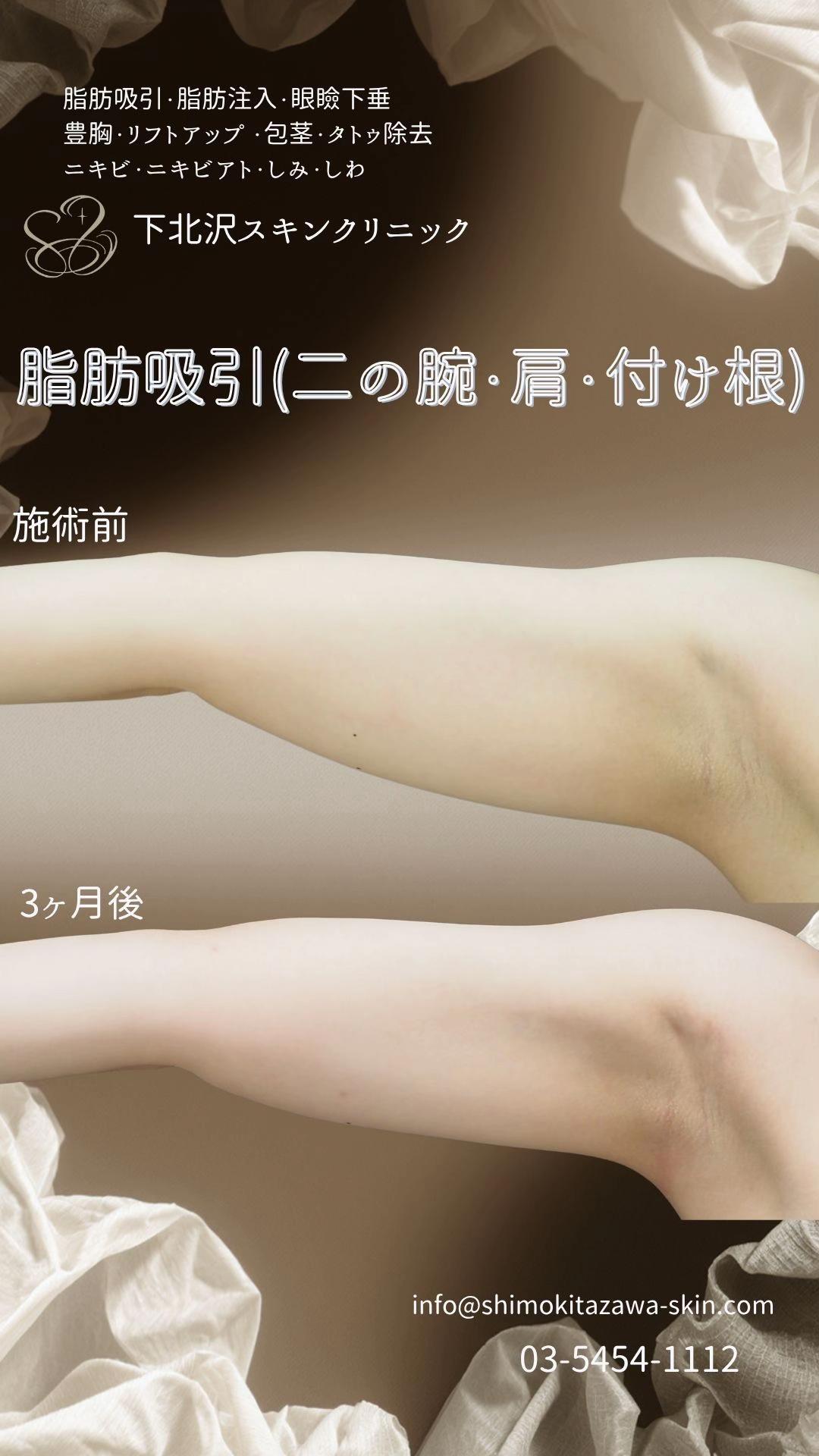 @下北沢スキンクリニック院長・こころの美容外科医・保坂宗孝