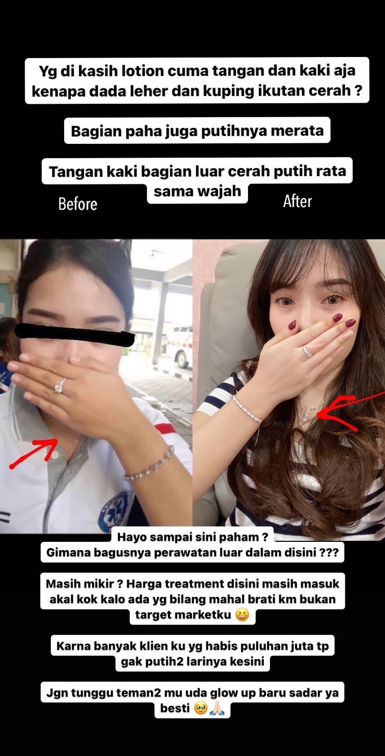 @Hainon