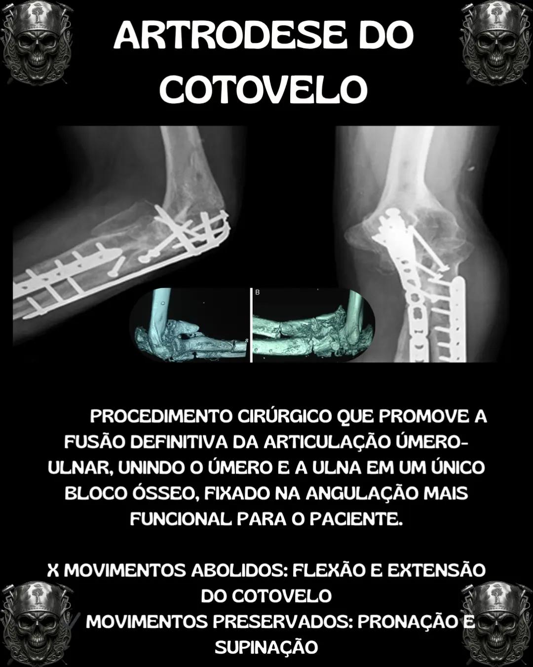 @Traumatologia Maluca