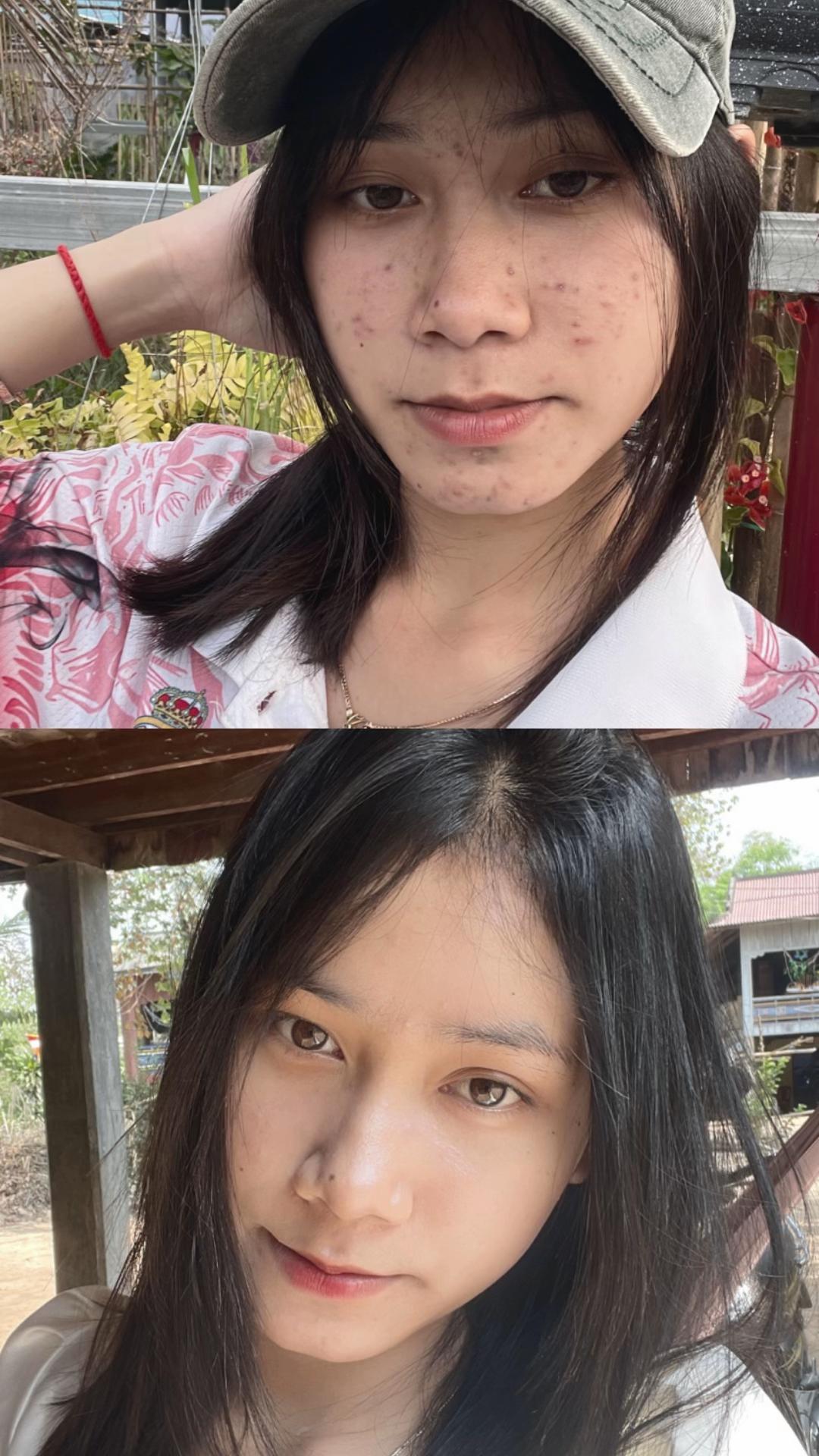 @17 May