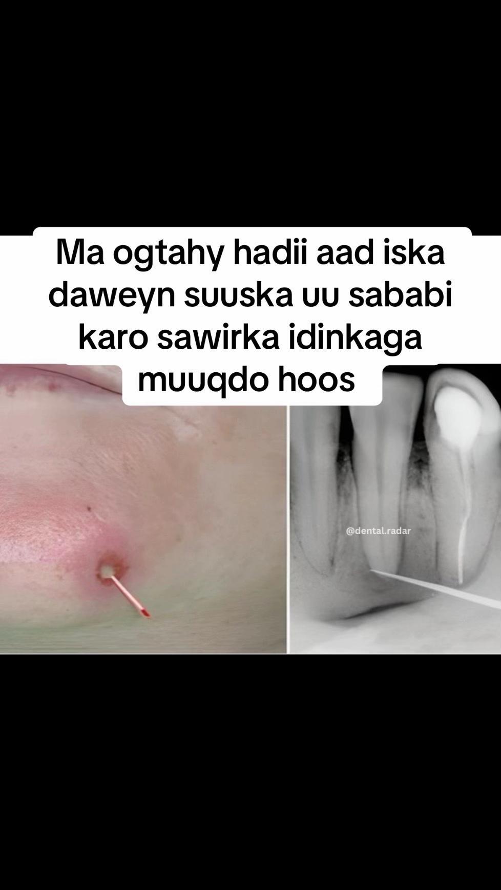 @Dr Abdirahman hassan laari