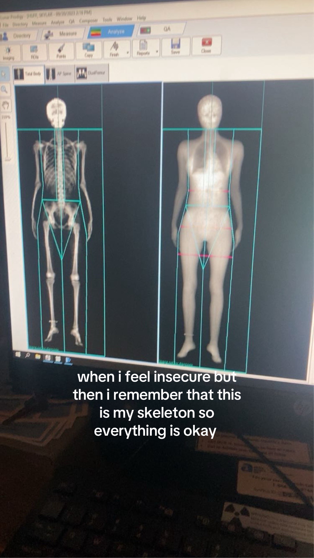 @Sky