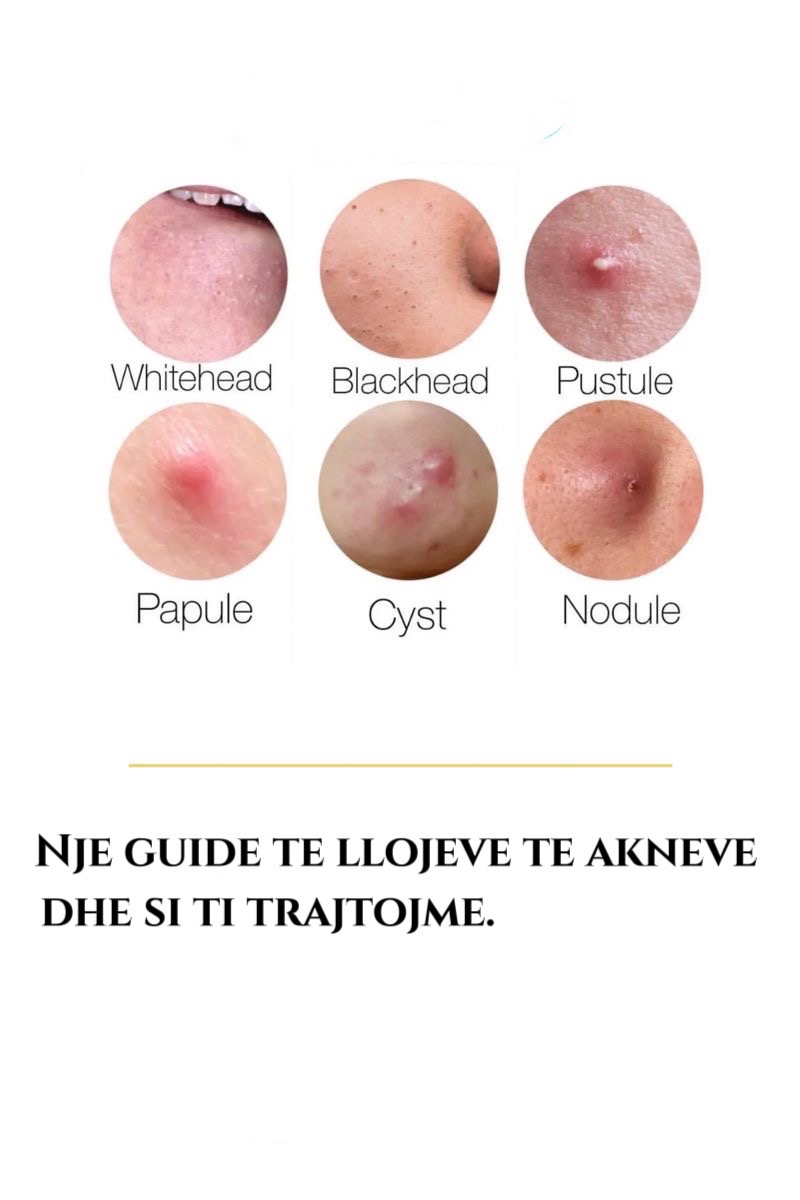@RadiantSkin.al
