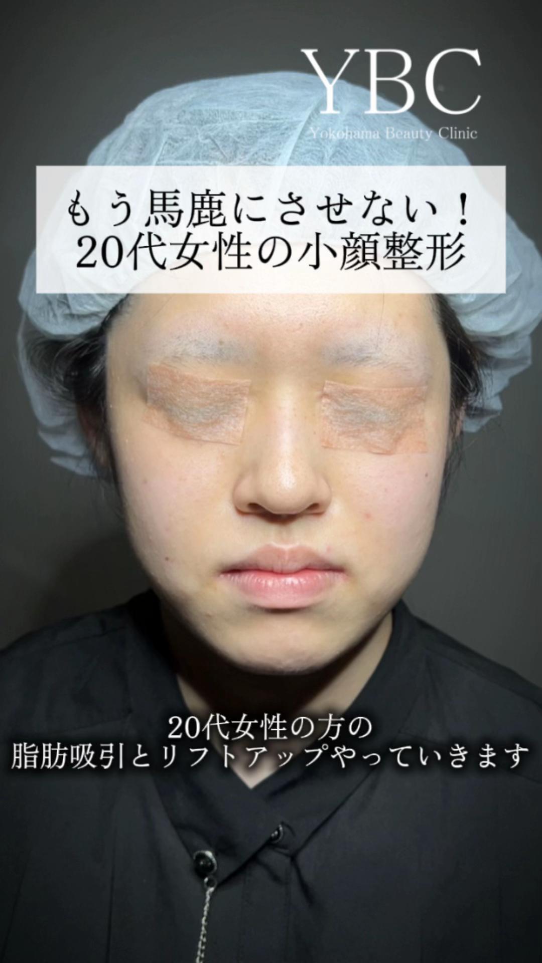 @イソセン/美容外科医（磯村亮輔院長）