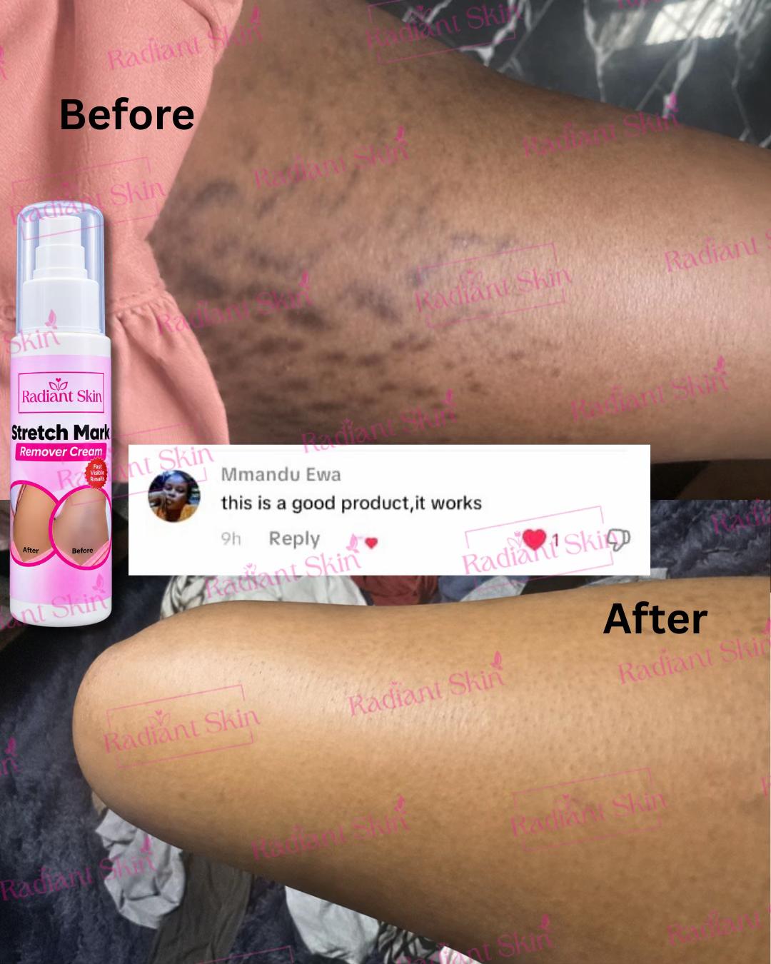 @Radiant skin