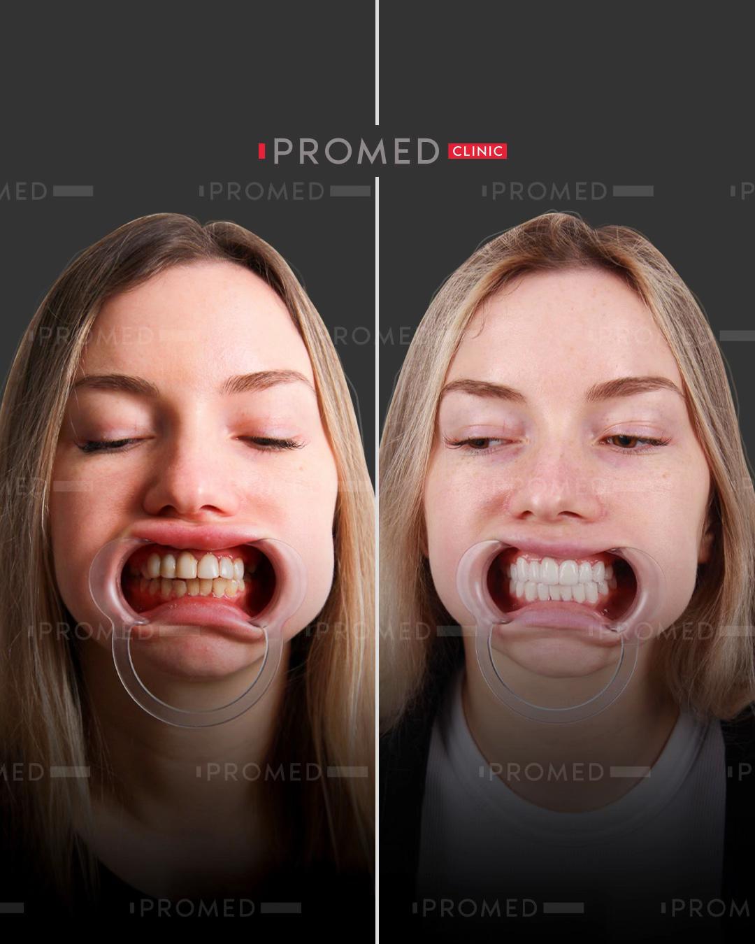@promeddentalclinic