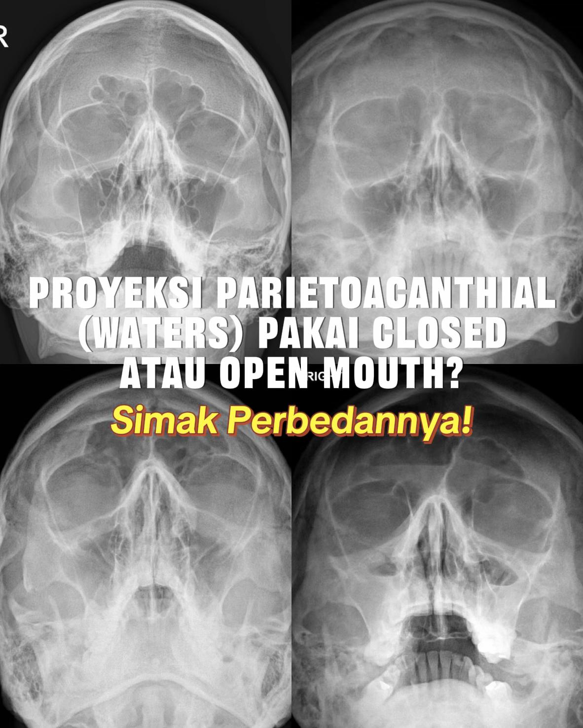 @Sobat Radiology