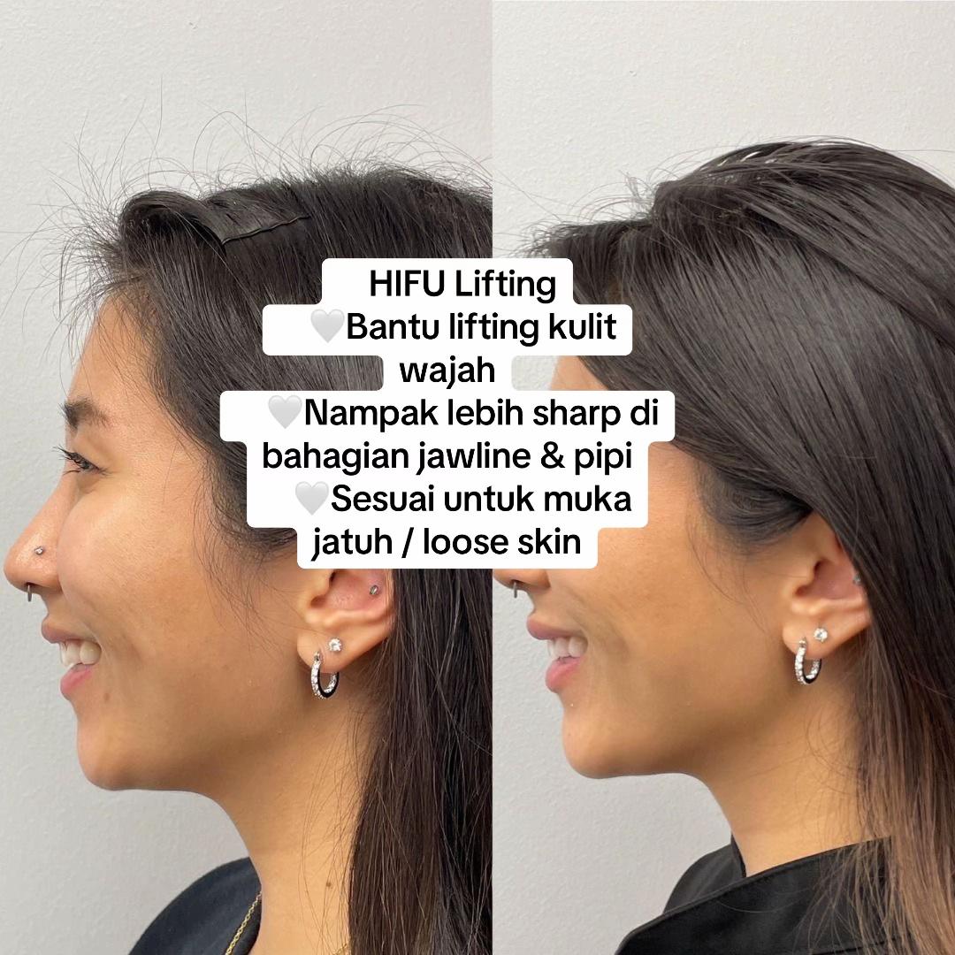 @SPA DVILLA SKIN & SLIM EXPERT