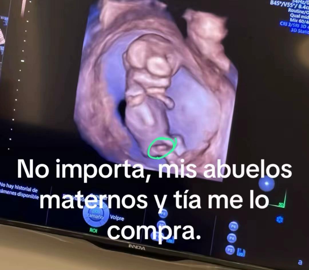 @Katherine Coronel🇪🇨