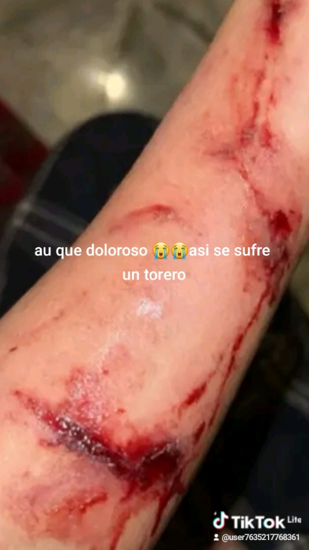 @Jhonny blas