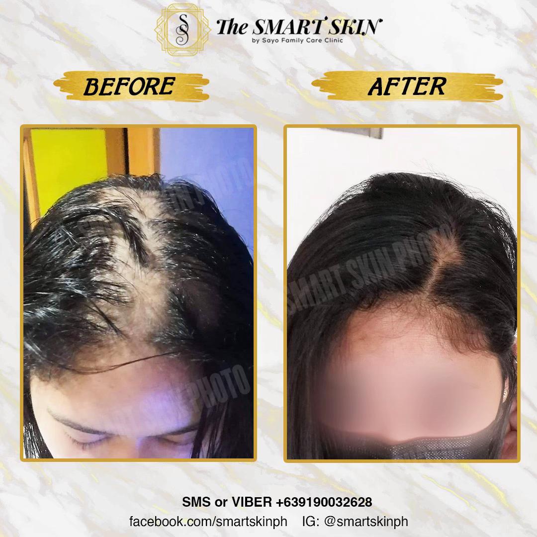 @The Smart Skin- Malolos