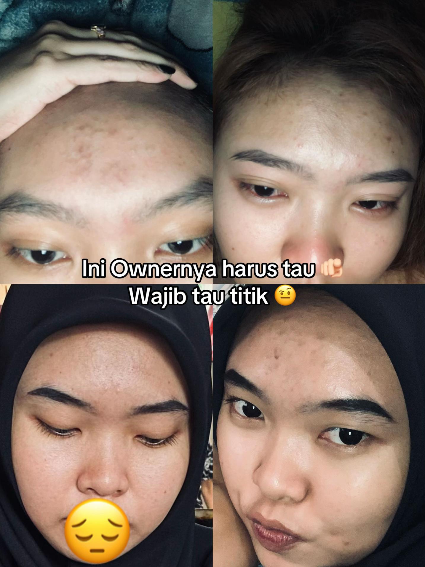 @Ochaaa