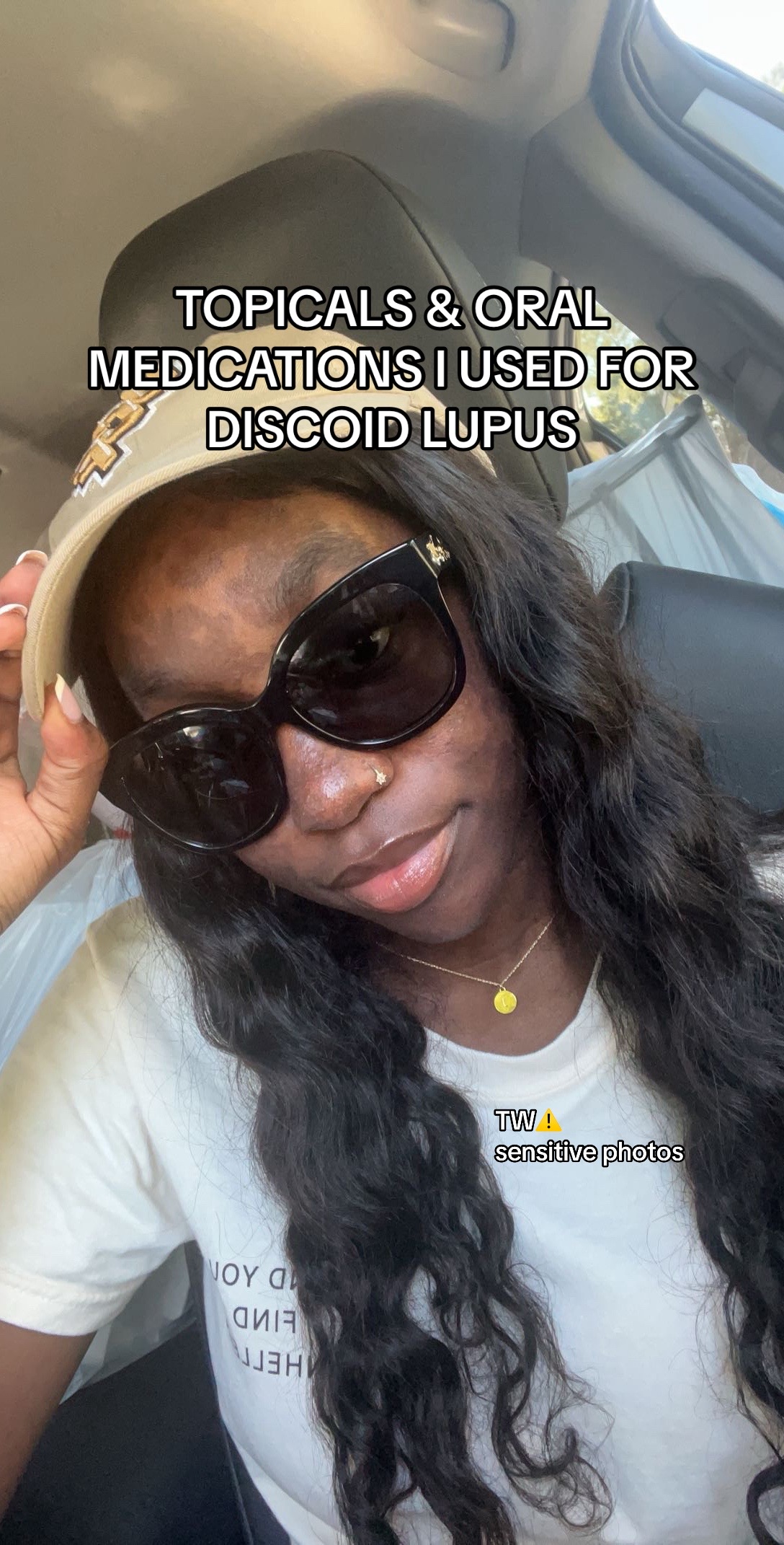 @jeneva | lupus warrior