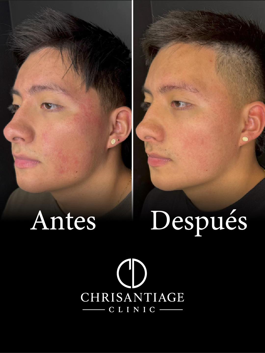 @chrisantiage