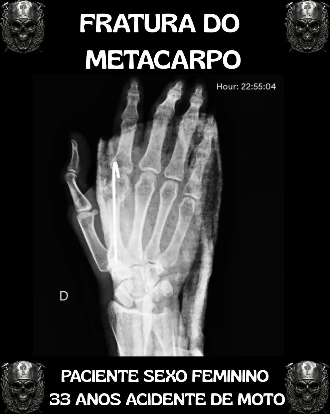 @Traumatologia Maluca