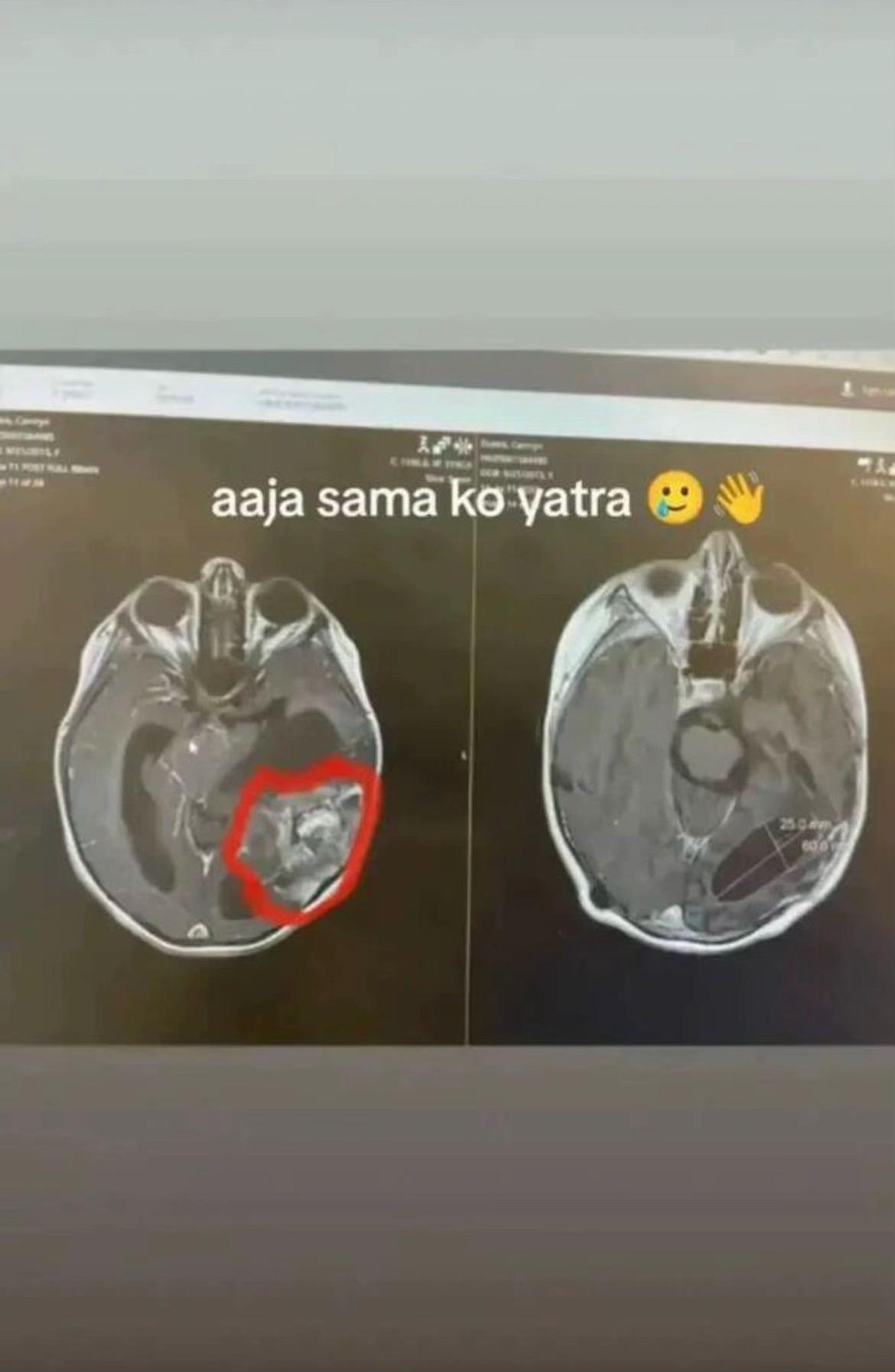 @Sanju Thakuri 🥺🥀😔😔🥀🥀🥀?