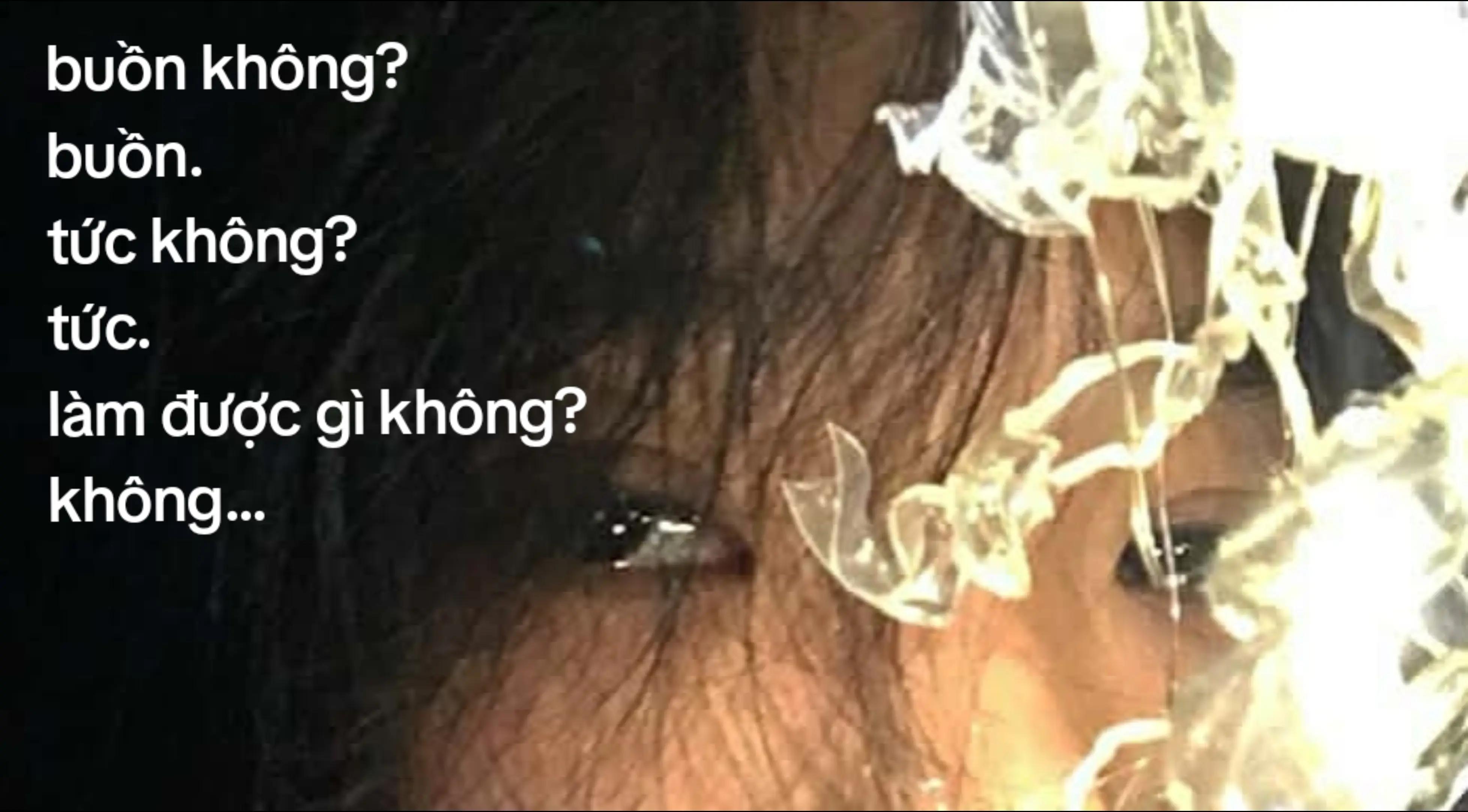 @N&agrave;o gầy đổi t&ecirc;n