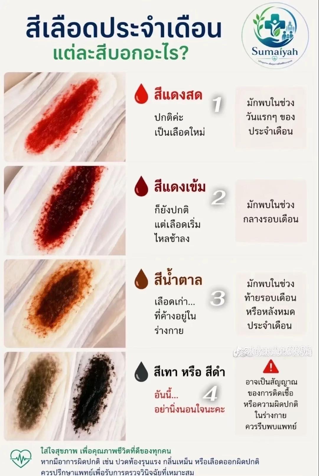 @๐ฆเบชเบฒเบงเบกเบปเปเบเบเบปเปเบเบฎเบฑเบเปเบเป๐