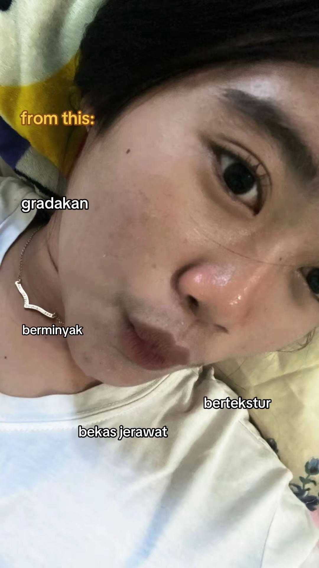 @IMAAAAAwWwW🪼