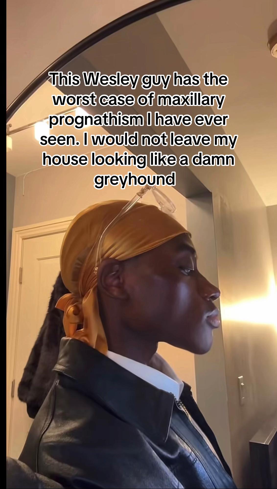 @forced