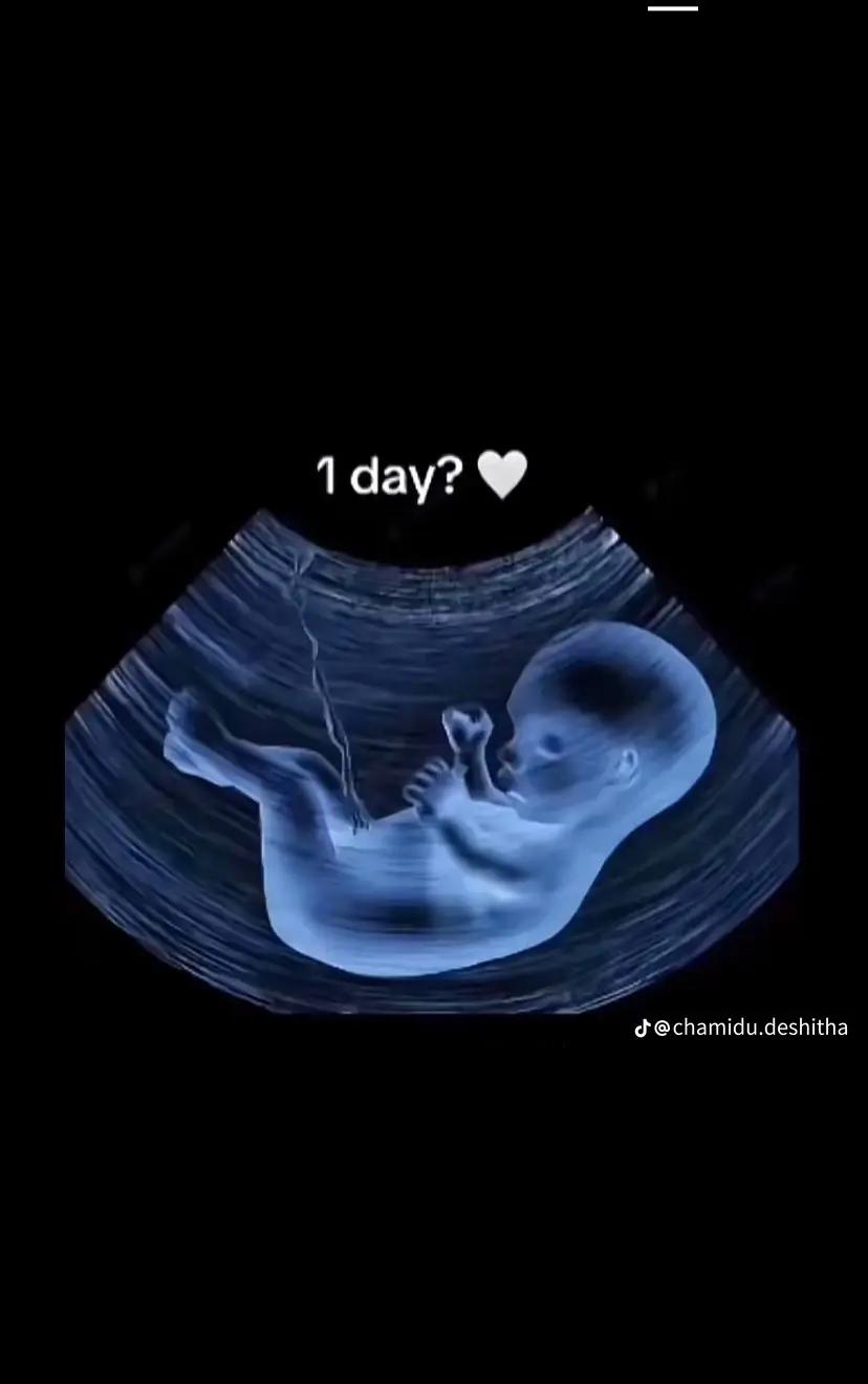 @Chanidu❤️🥰❤