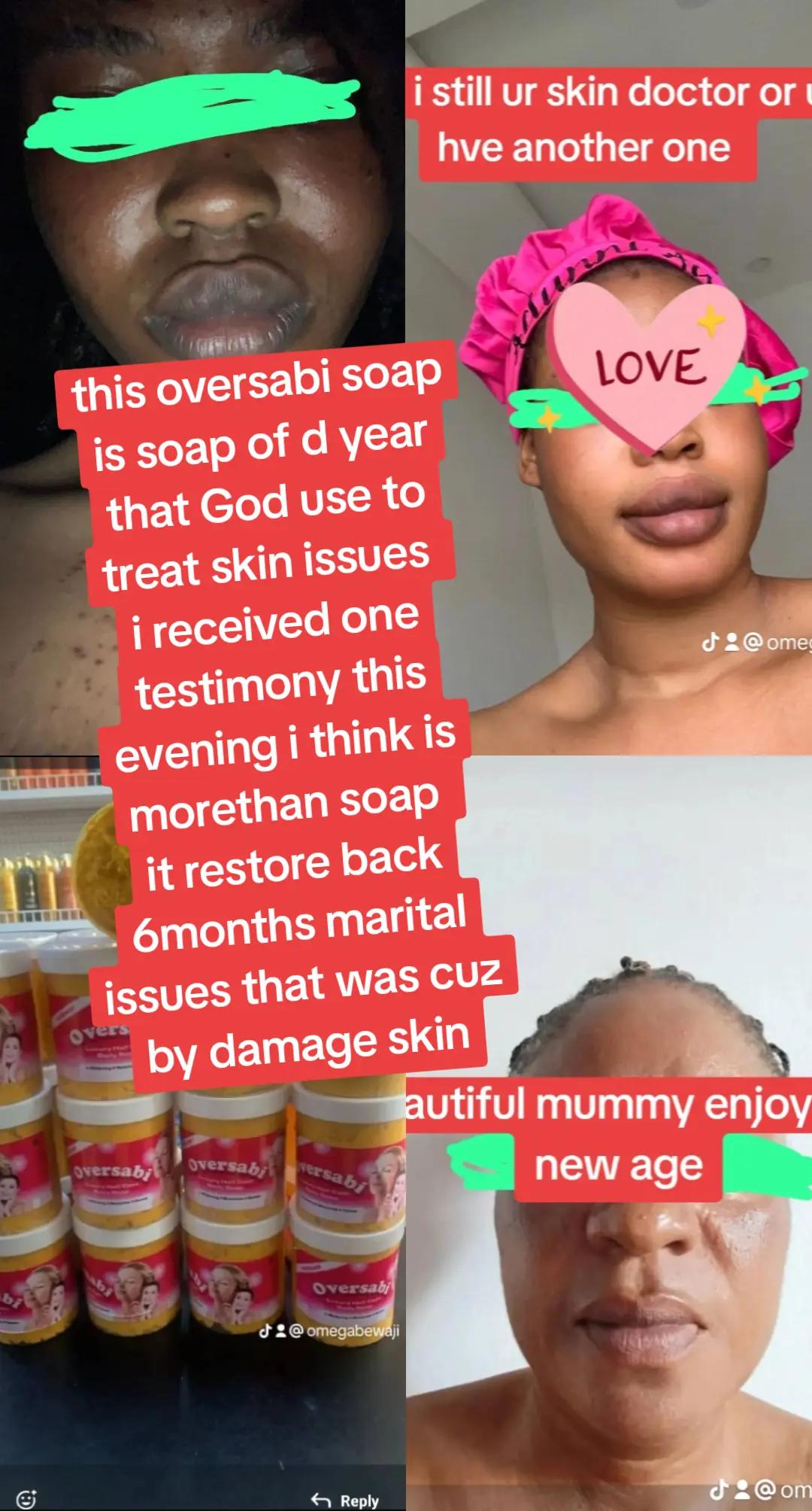 @OMEGA COSMETIC,MYSKIN MYPRIDE