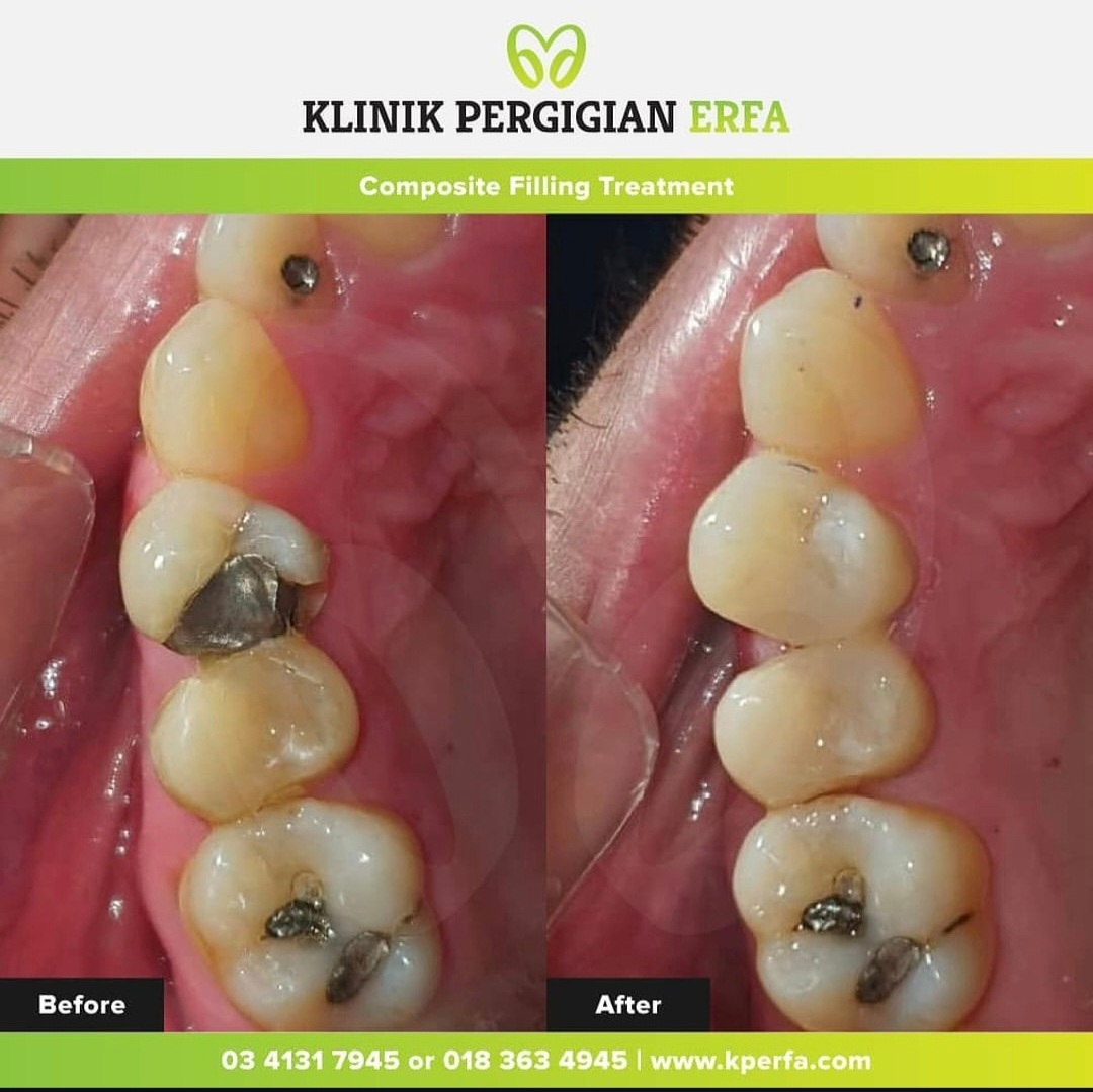@Klinik Pergigian Erfa