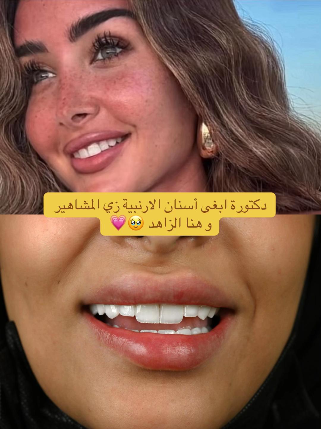 @Dr.ranaalsilani