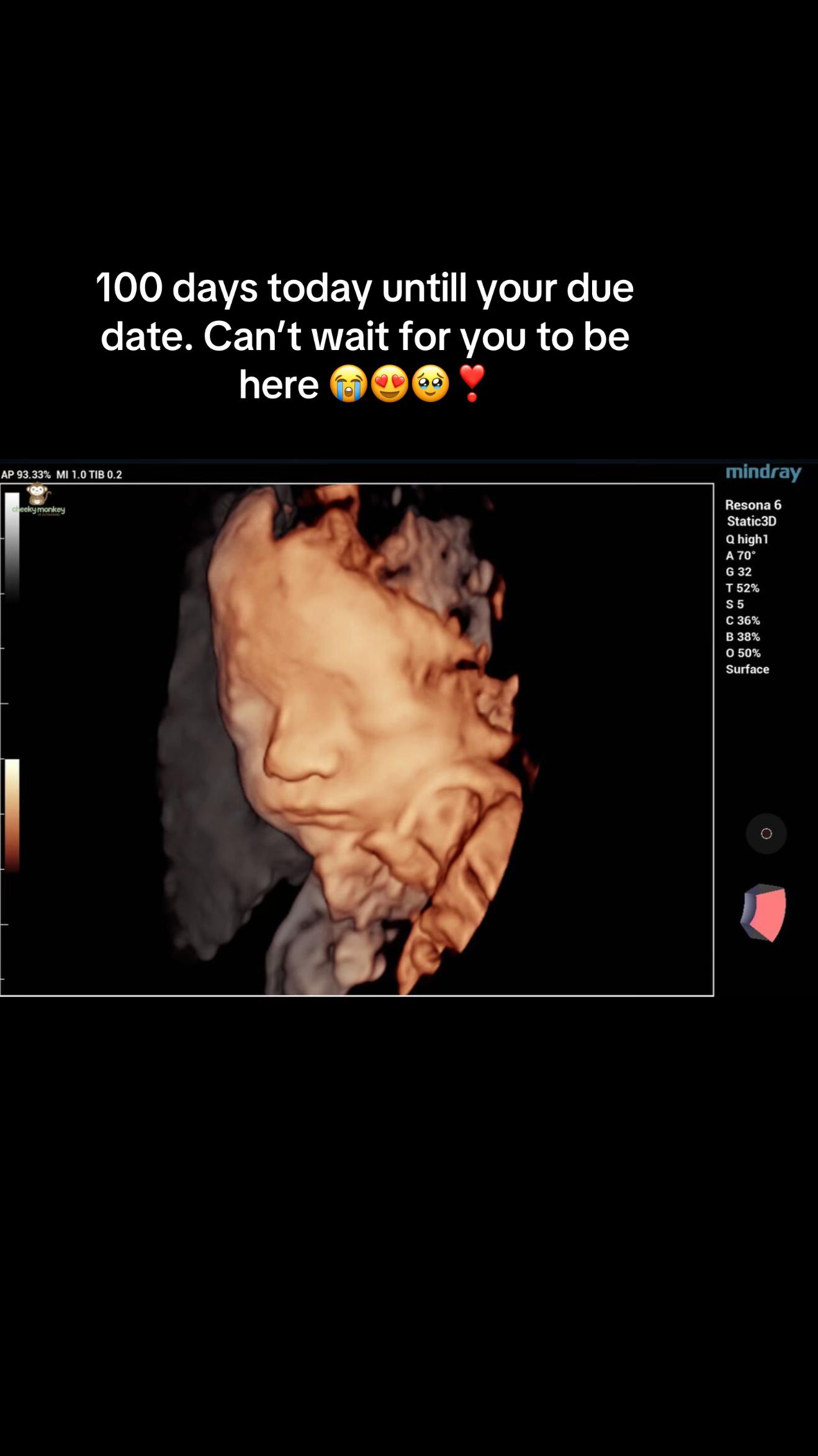 @ℤ𝕠𝕖ℂ𝕙𝕒𝕣𝕝𝕠𝕥𝕥𝕖🦋🤍
