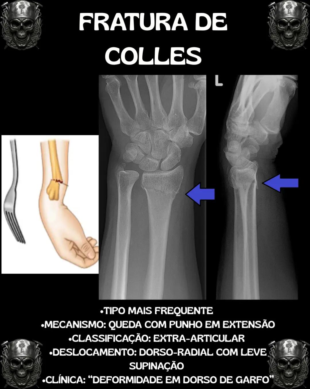 @Traumatologia Maluca