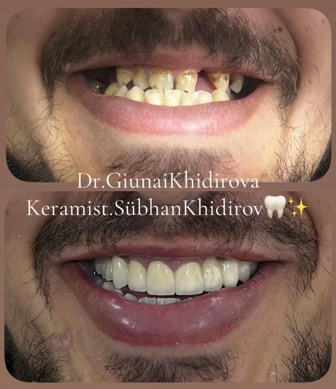 @Dr.Гюнай