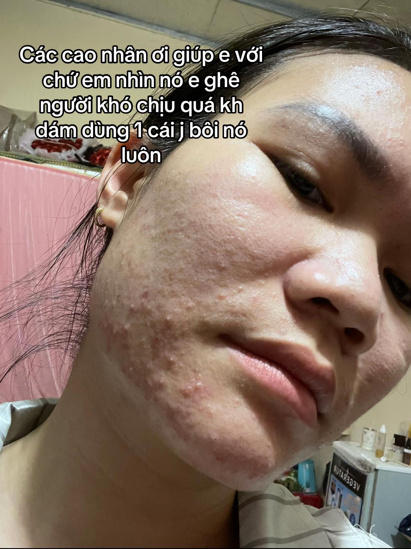 @Chị Nhím🐥